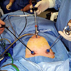 Ξηρομερίτης Μ. Ουρολόγος -  Λαπαροσκοπική Χειρουργική