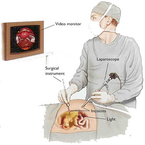 Ξηρομερίτης Μ. Ουρολόγος - Λαπαροσκοπική Χειρουργική
